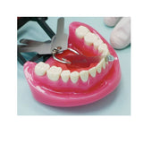 Dental Interproximal Reduction Gauge Ruler Tooth Gap Measure