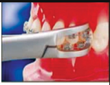 Dent Art Bracket Removing Plier, Angulated, Orthodontic Instrument 