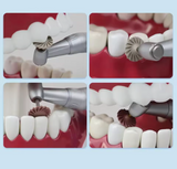 All Surface Access Polishers , Spiral -6/Pk