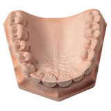Snap-Stone, Type IV, 11 lbs, Pink, 1/Pk, 23690