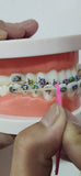 Dent Art Dental Elastic Rubber Bands Placers for Braces Disposable Plastic Orthodontic Elastic Placers Multi-color