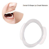 Dental O-shape Intraoral Cheek Lip Retractor Opener