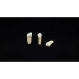 A27#22C 2.2 Class III MD Composite Resin Teeth with Caries