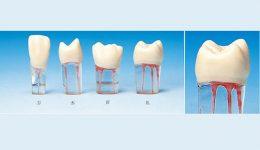 S12 Endo Teeth 